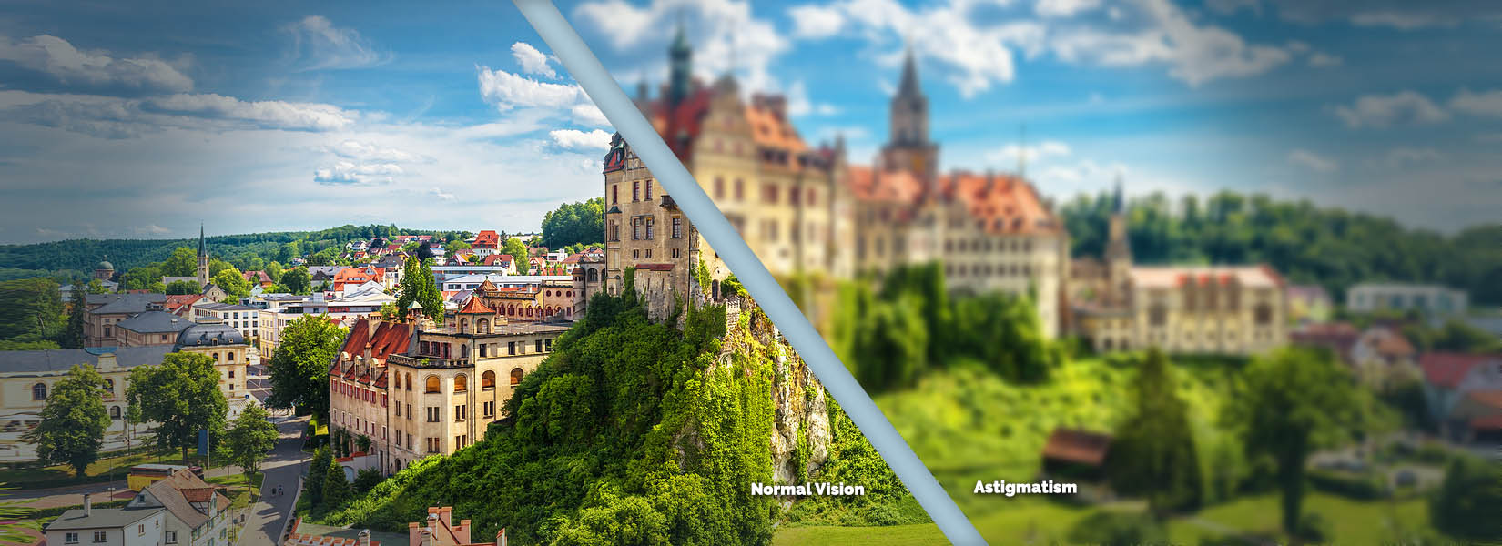 Astigmatism Treatment in Hartley