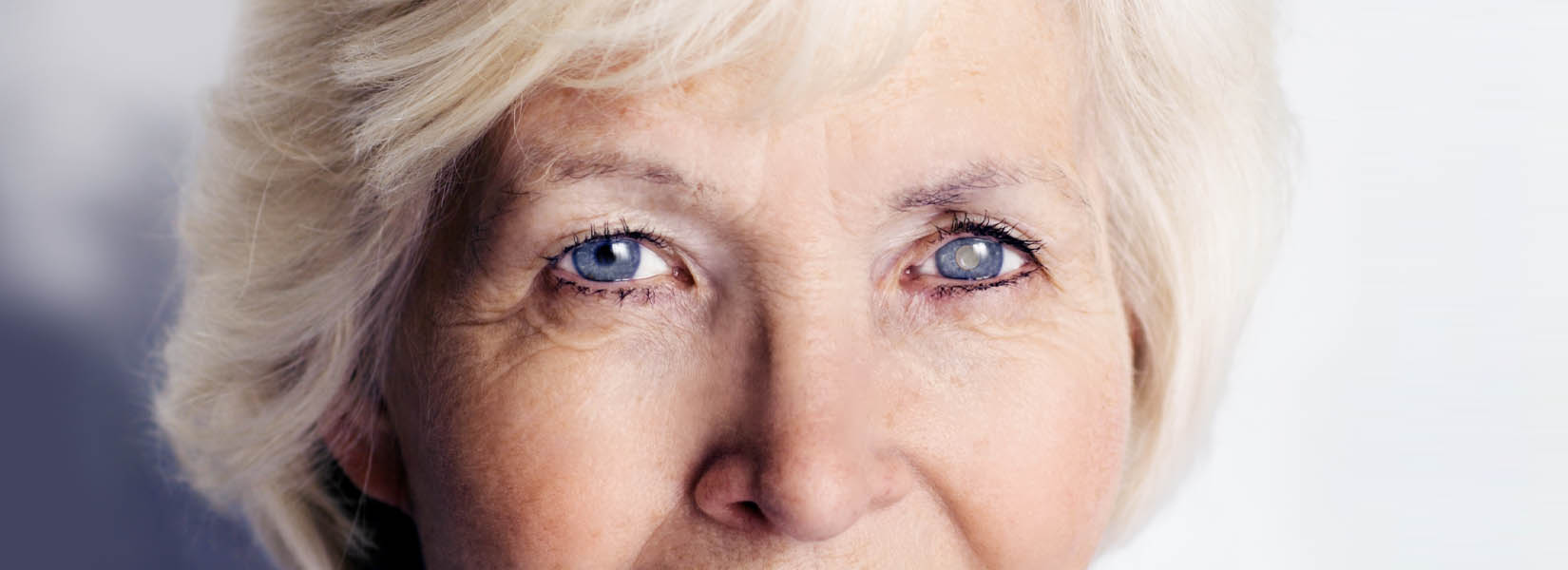 Cataract Surgery in Hartley